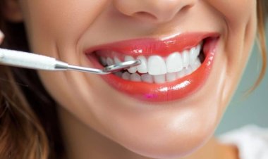 Veneer in Dubai Redefine Your Smile with Lasting Elegance